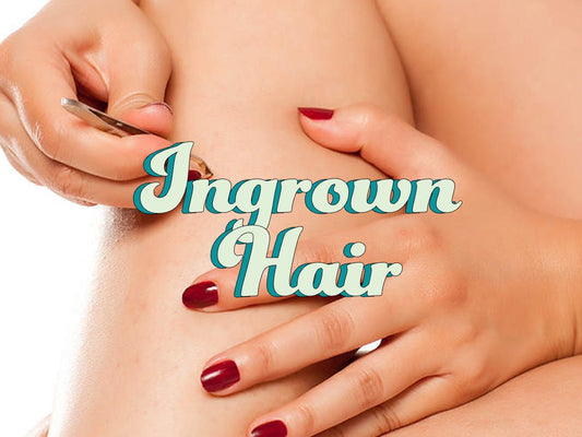 Ingrown Hair