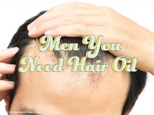 Men Need Hair Oil For Their Receding Hair Lines