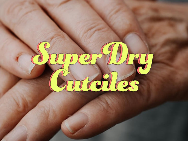 best cuticle oil for super dry cuticles
