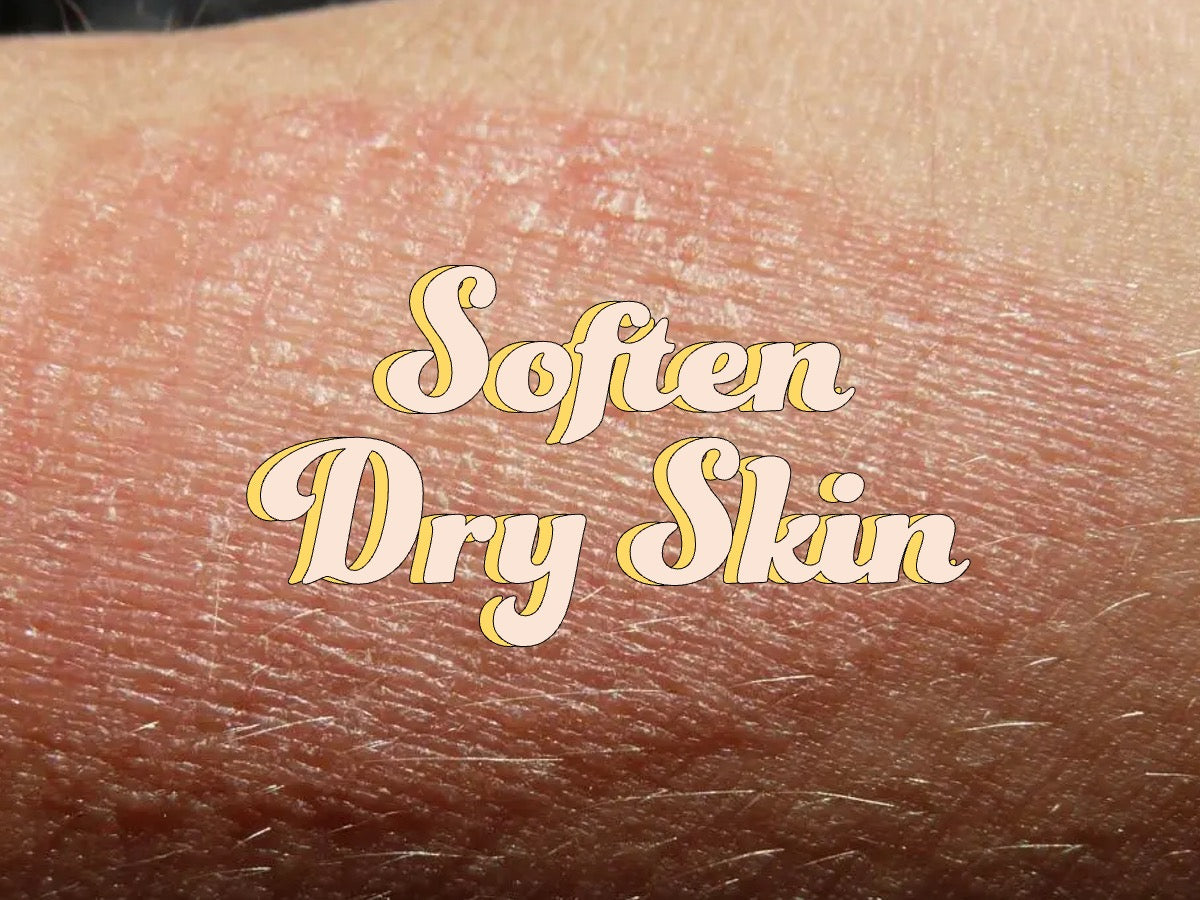 Soften dry skin with body moisturizer