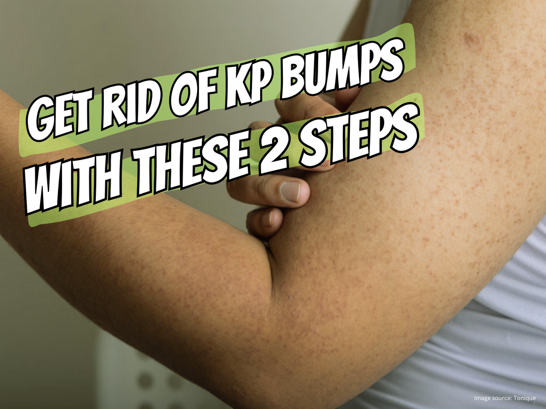 get rid of kp bumps with these 2 step