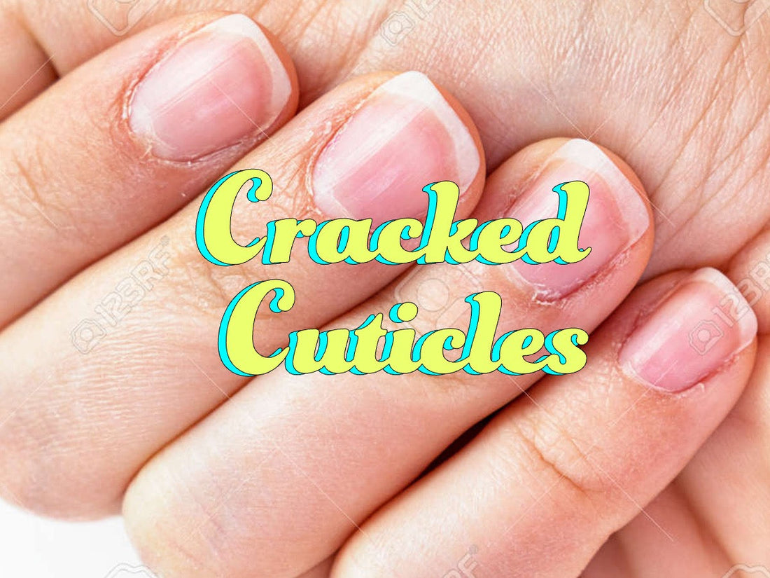 nail cuticle oil for dry cuticles