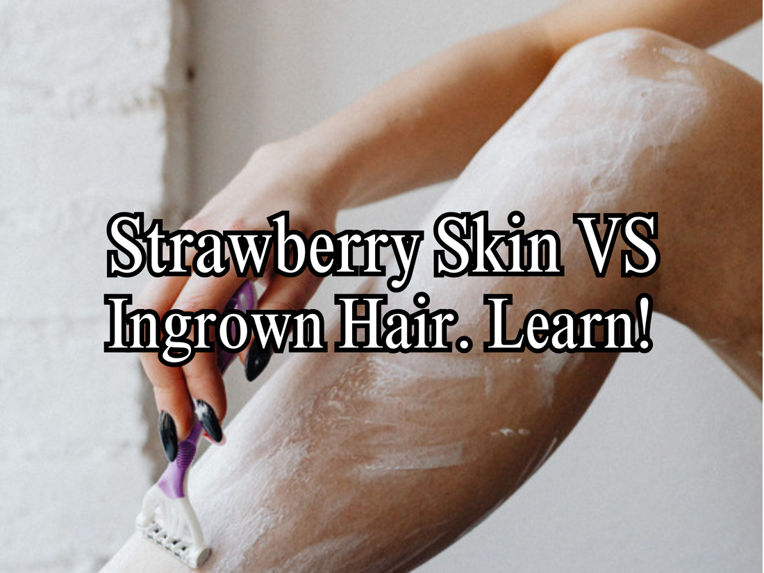 Strawberry Skin vs. Ingrown Hairs