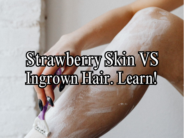 Ingrown hair vs strawberry skin