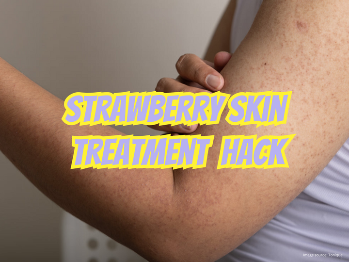 Hacks for Strawberry skin treatment