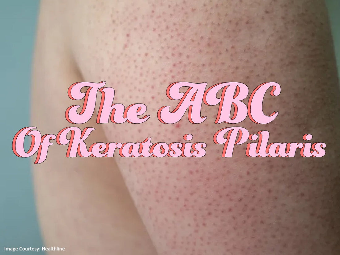 The ABCs of Keratosis Pilaris!