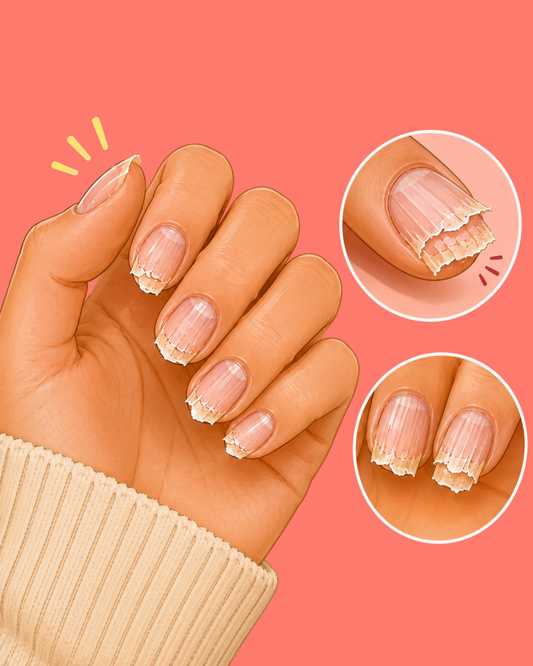 Why Do Nails Peel and Break? What Your Nails Are Actually Telling You