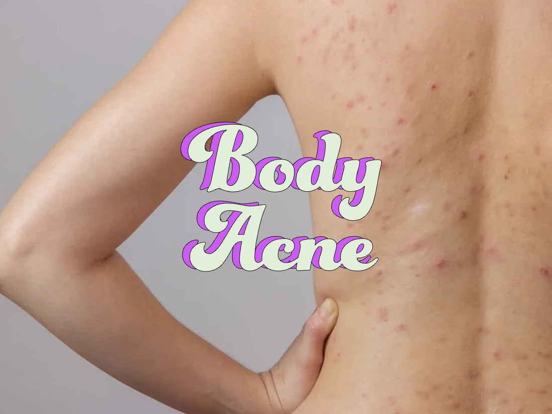 in-shower body moisturizer for body acne care