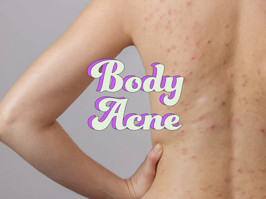 in-shower body moisturizer for body acne care