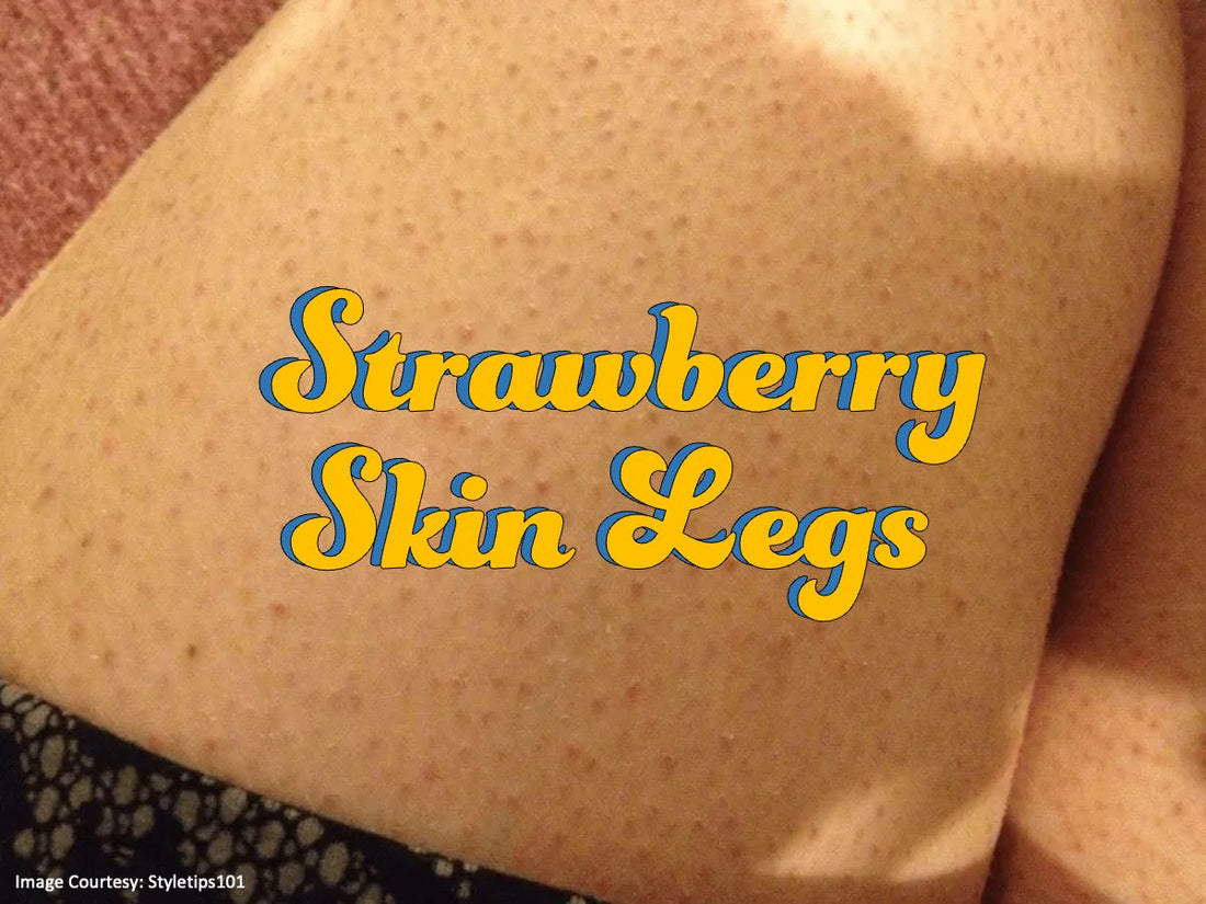 strawberry legs treatment