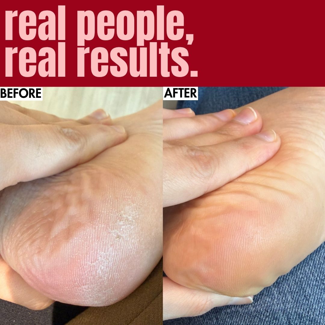 The Foot Balm