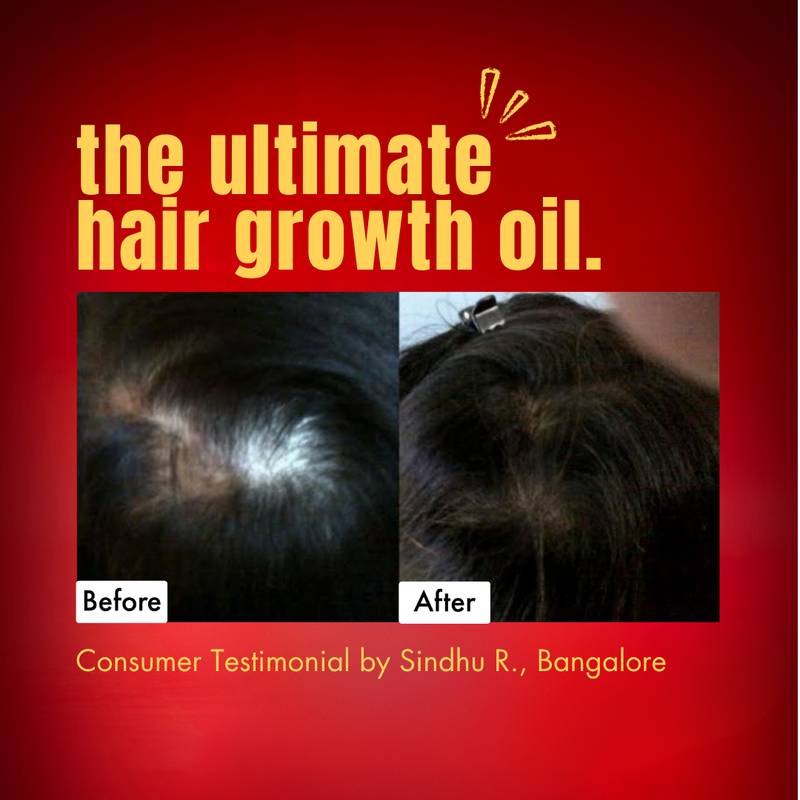 HM Love Scalp & Hair Oil - The Tin Edit