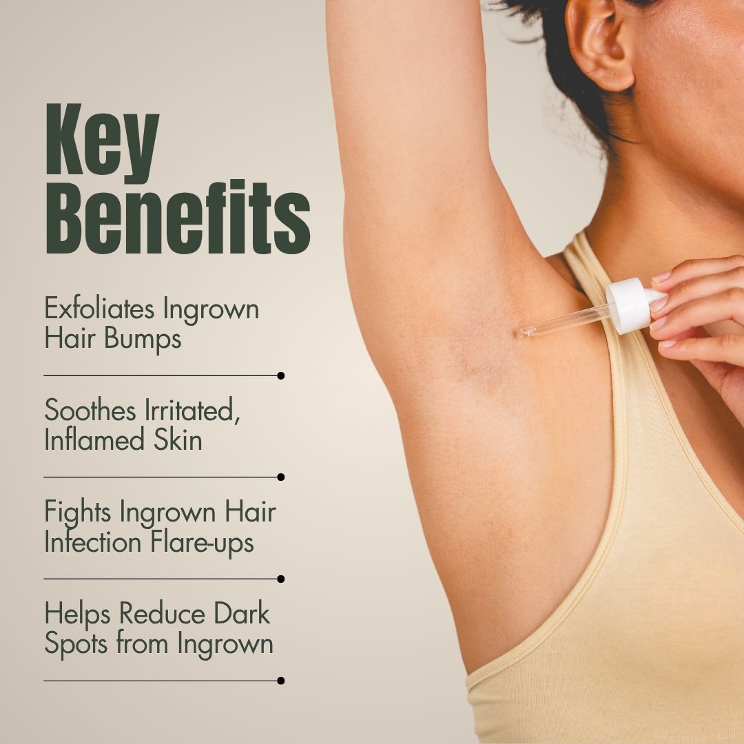 Ingrown Hair Treatment