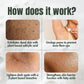 Ingrown Hair Treatment
