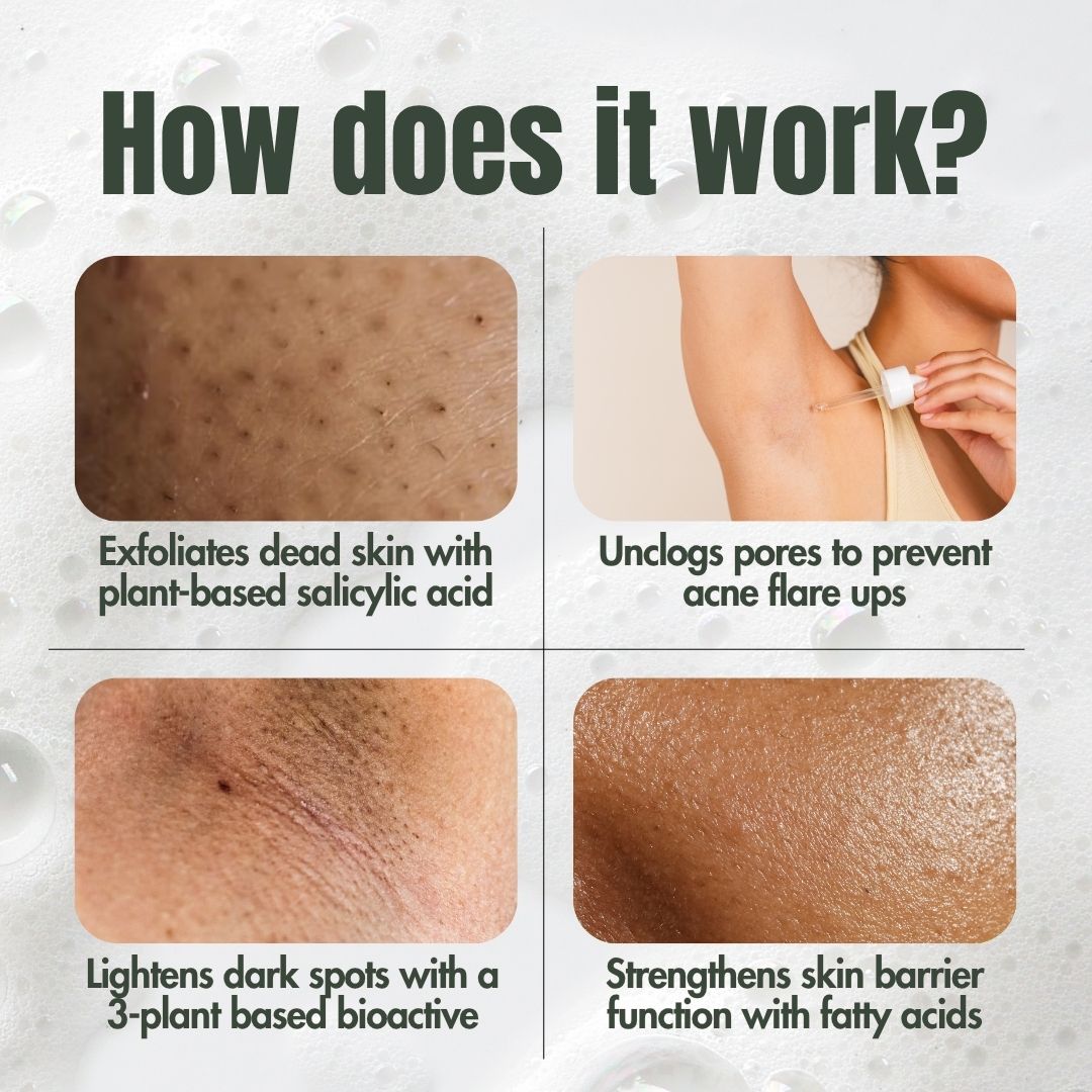Ingrown Hair Treatment