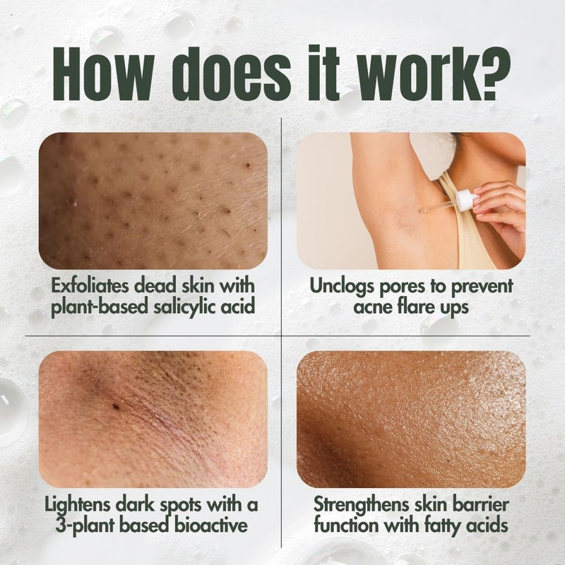 Ingrown Hair Treatment