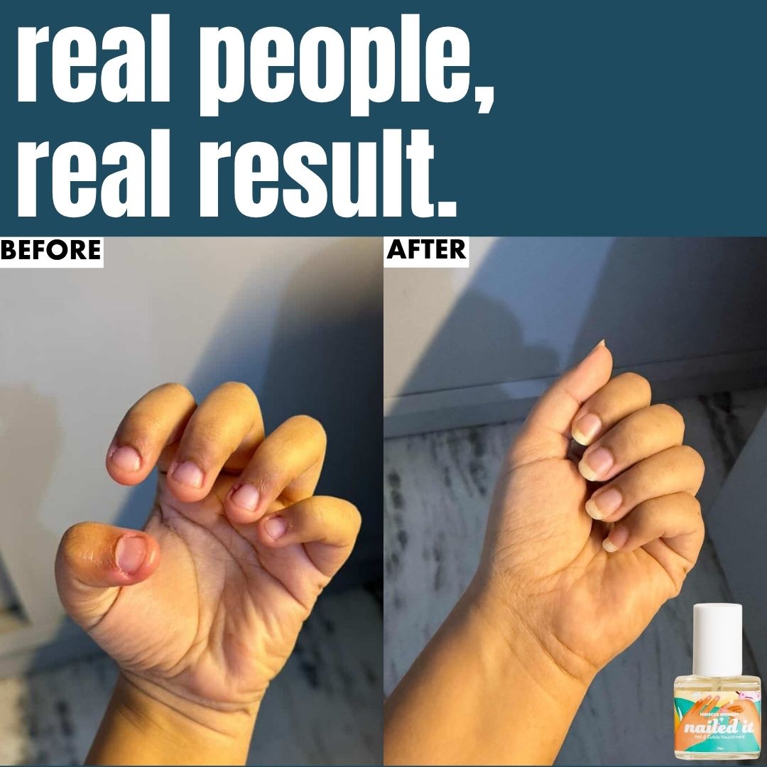Nailed It