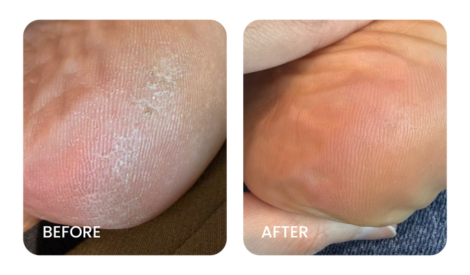 Before and After