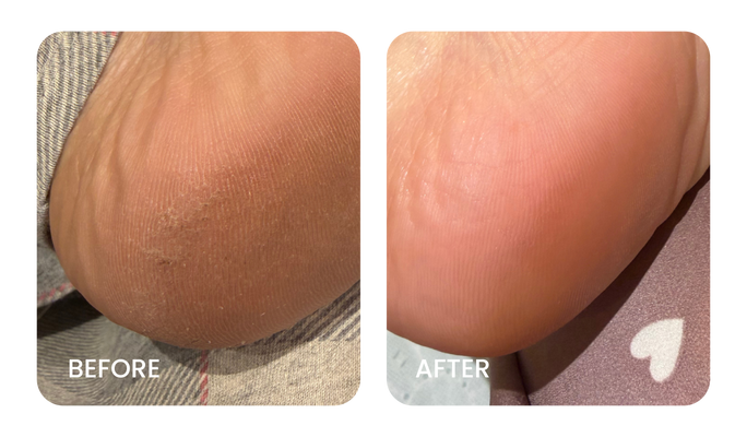 Before and After
