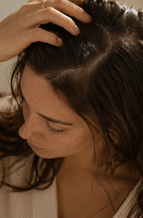 Dry Scalp