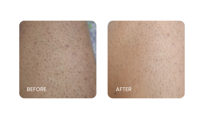 Before and After