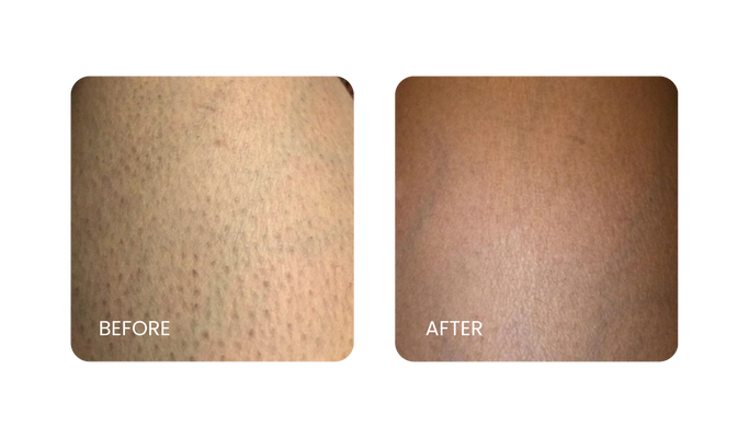 Before and After