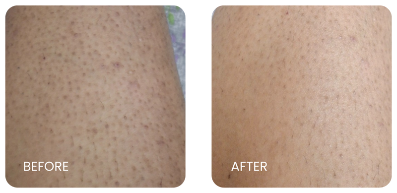 Before and After