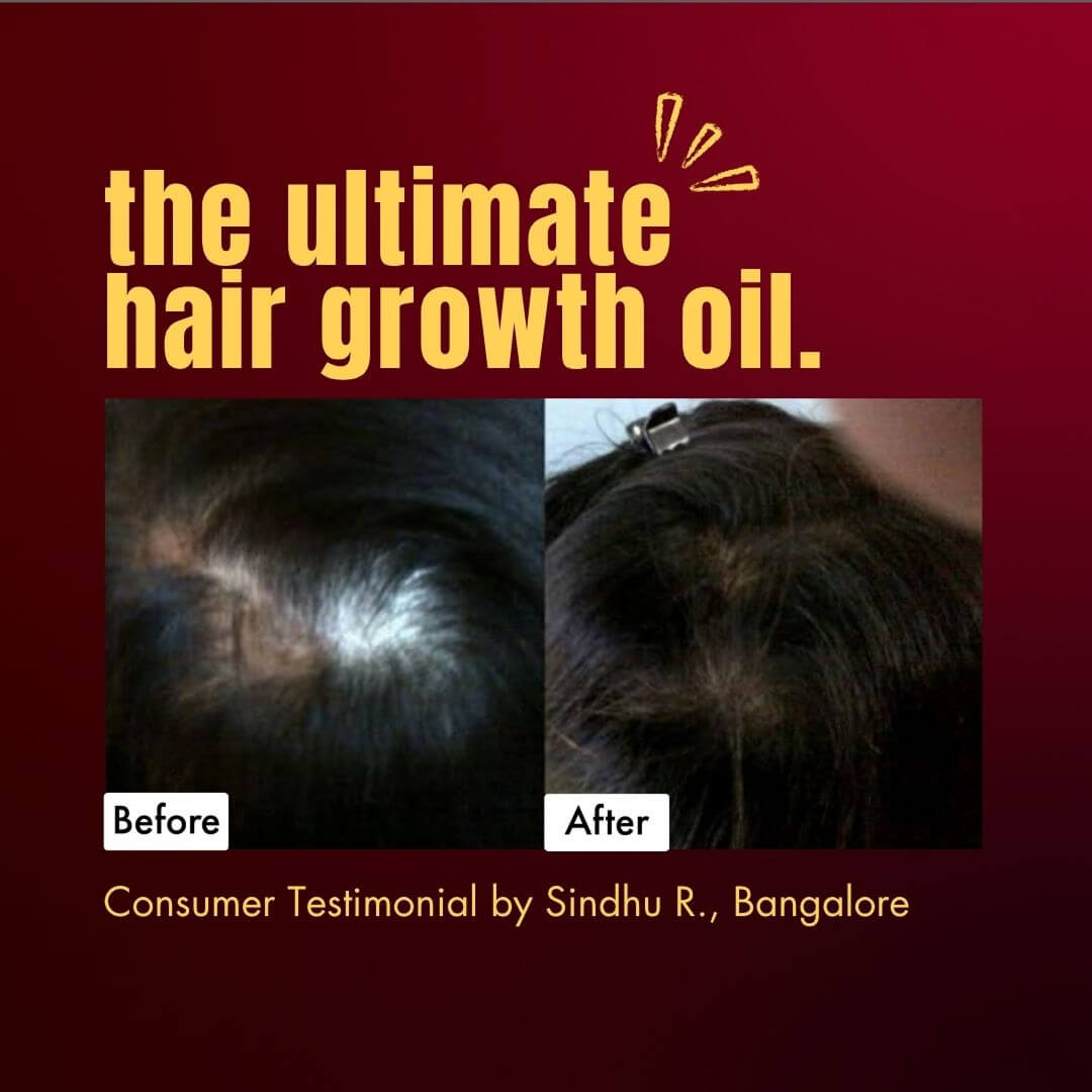 Before & After Love Hair growth and Scalp oil