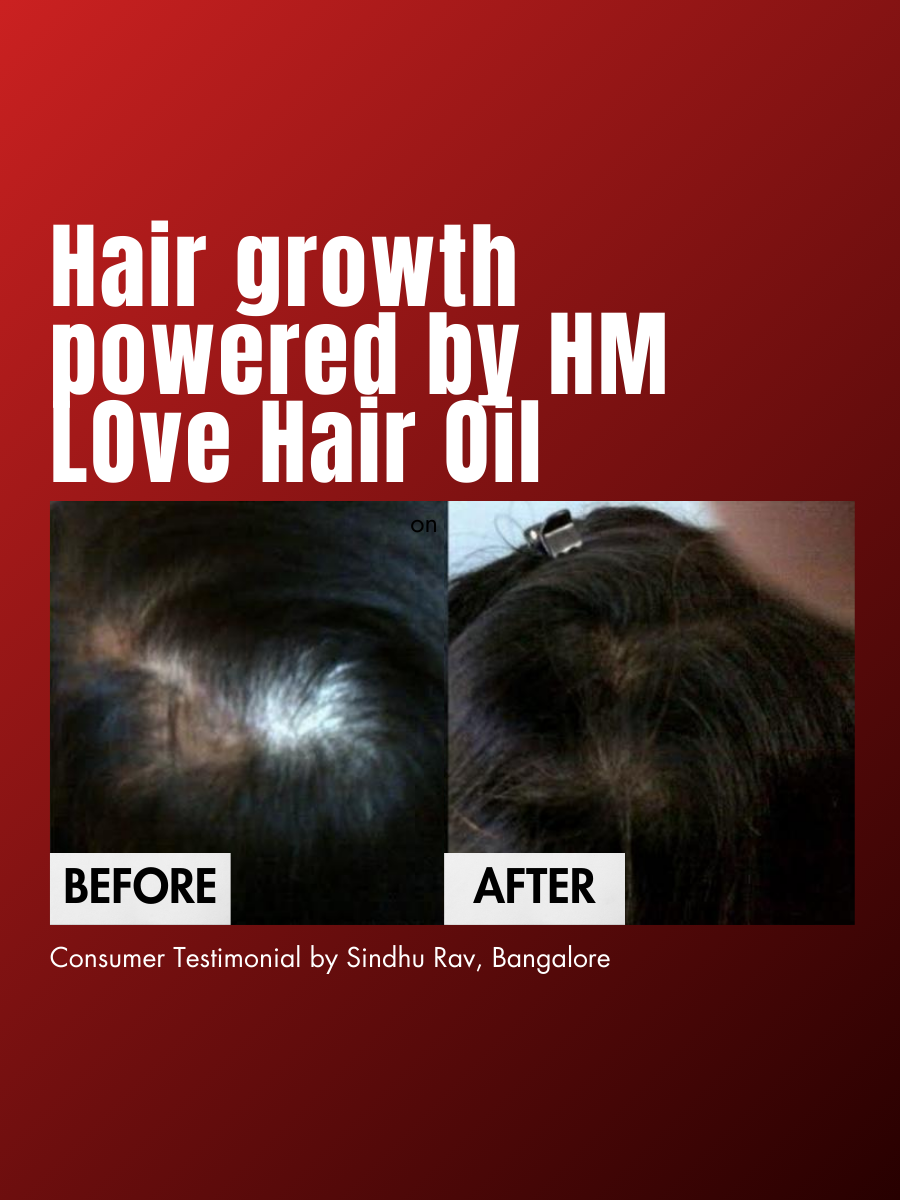 Before and after using Hibiscus Monkey Hair Growth Oil
