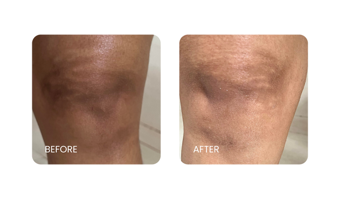 Before and After