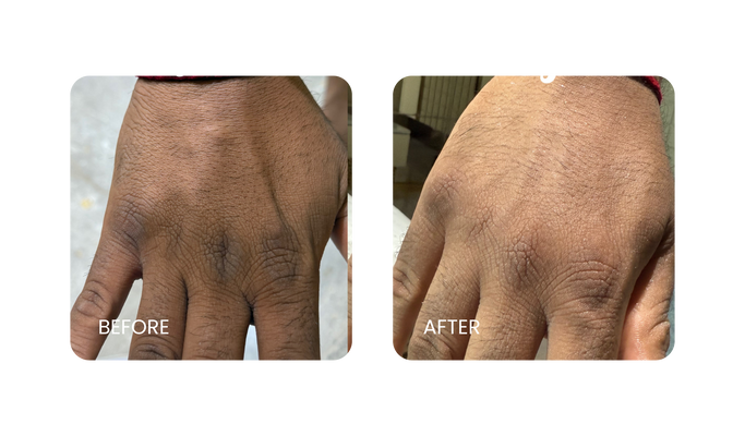 Before and After