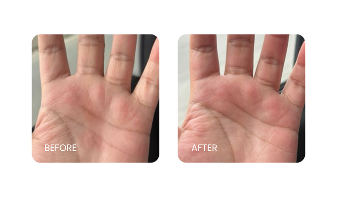 Before and After