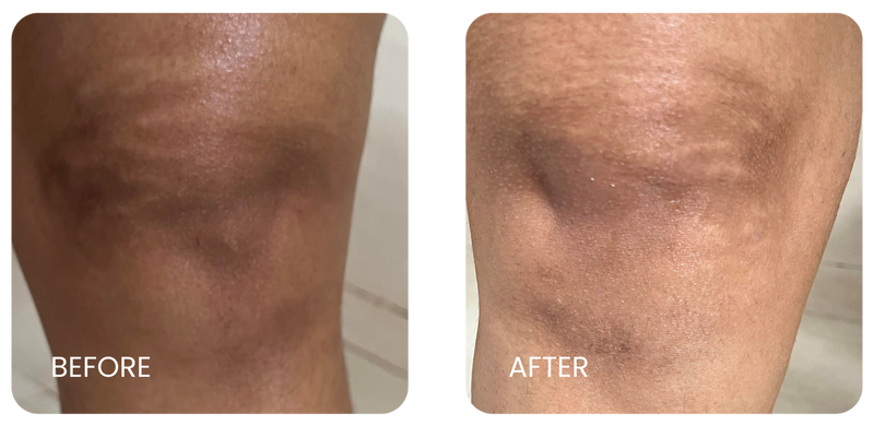 Before and After