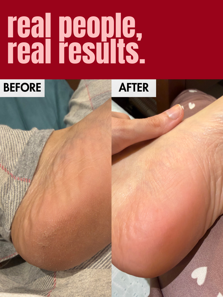 Honest Reviews of using nourishing foot balm by Hibiscus Monkey