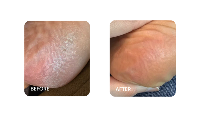 Before and After