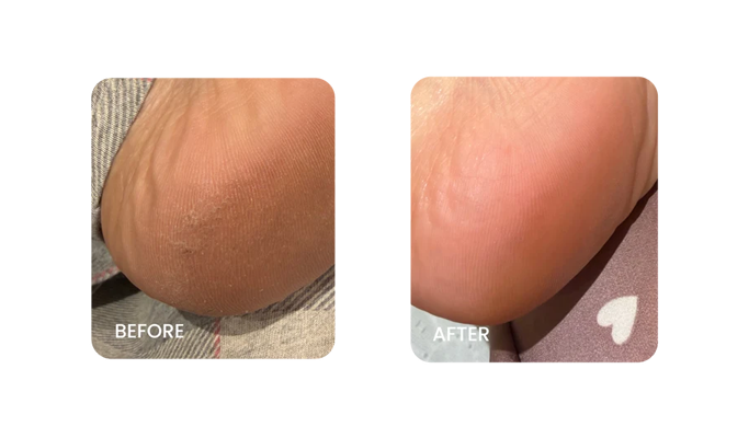 Before and After