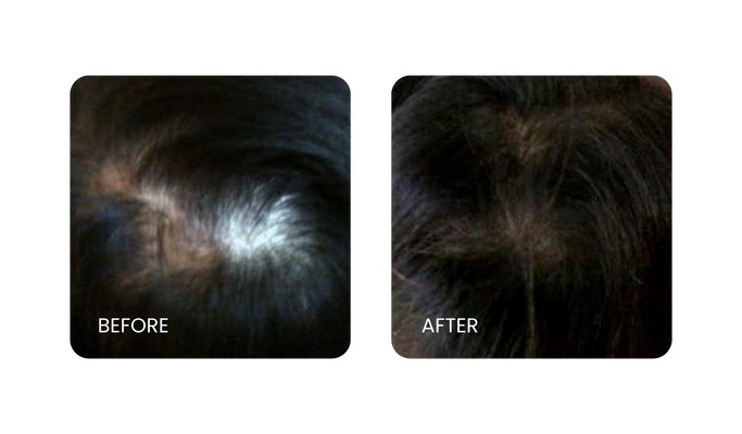 Before and After