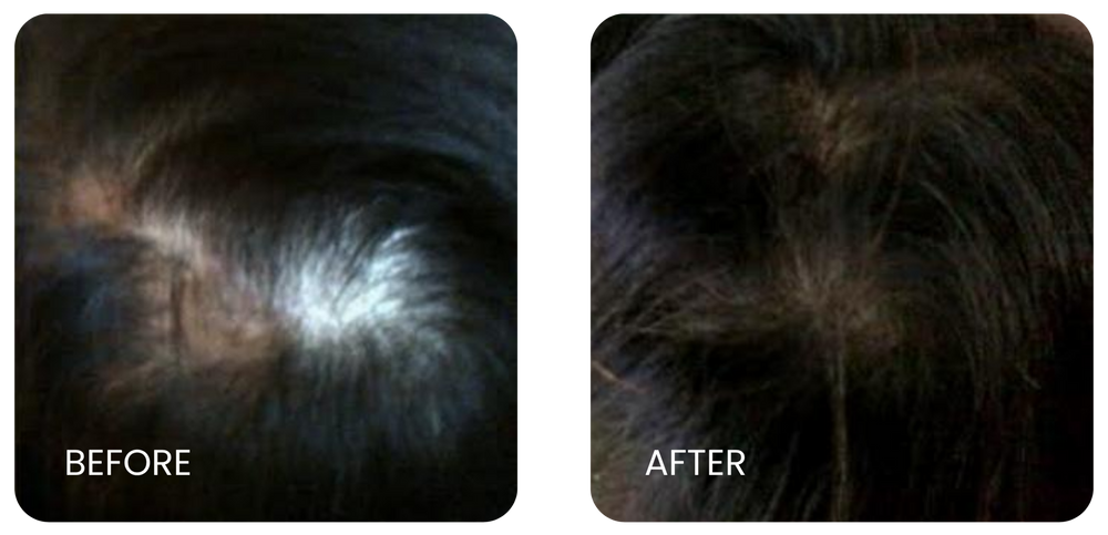 HAIR Fall result