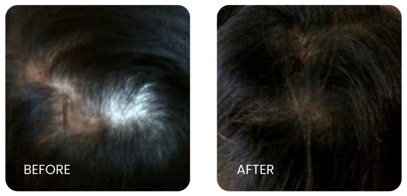 Before and After