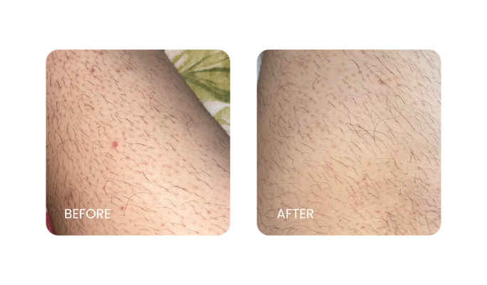 Before and After