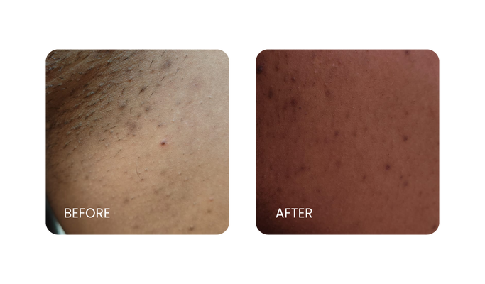 Before and After