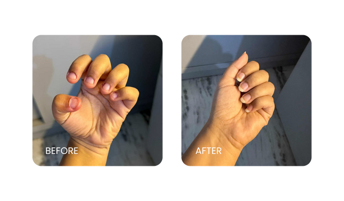 Before and After