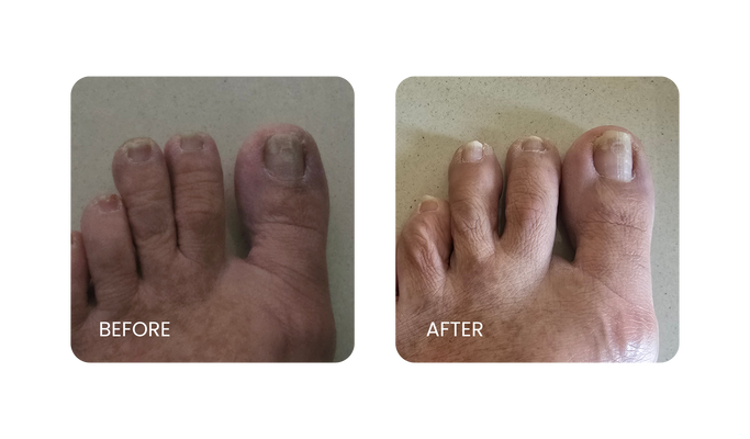 Before and After