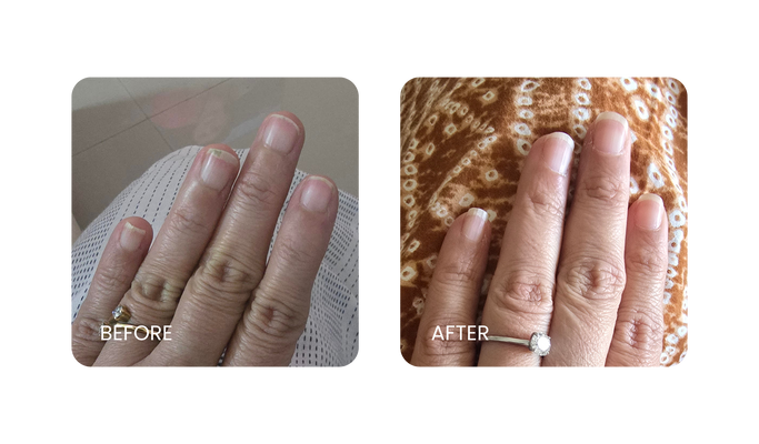 Before and After