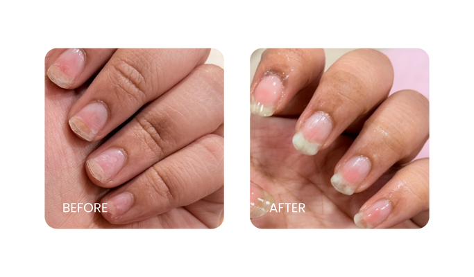 Before and After