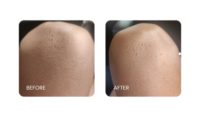 Before and After
