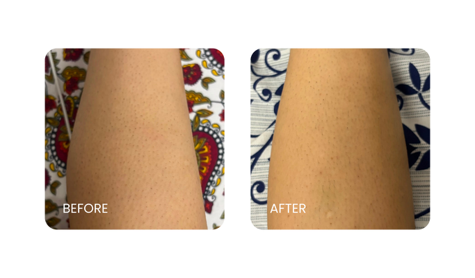 Before and After