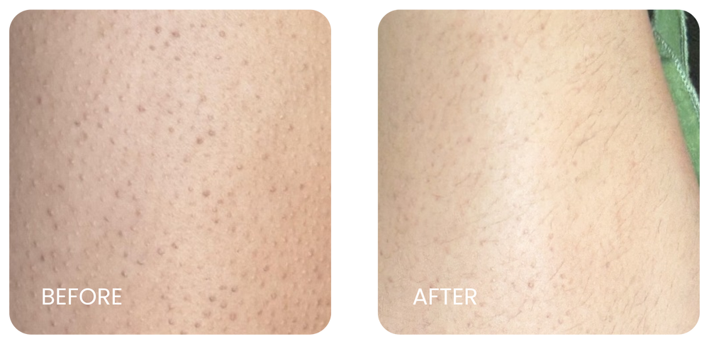 Strawberry skin result